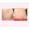 PDRN Pink Hyaluronic Moisturizing Cream 4