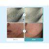 Azelaic Acid Niacinamide Clear Toner 5