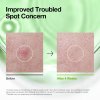 Azelaic Acid 3 Cica Skin Clarifying Toner 2