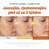 Kojic Acid Niacinamide Brightening Ampoule 5 SK